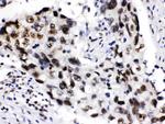 ADAR1 Antibody in Immunohistochemistry (Paraffin) (IHC (P))