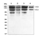 ADAR1 Antibody in Western Blot (WB)