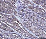 Alcohol Dehydrogenase 1A Antibody in Immunohistochemistry (Paraffin) (IHC (P))