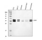 ADO Antibody in Western Blot (WB)