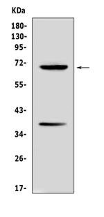 AFP Antibody in Western Blot (WB)