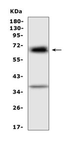 AFP Antibody in Western Blot (WB)
