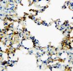 RAGE Polyclonal Antibody