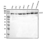 AGO2 Polyclonal Antibody