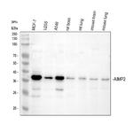 AIMP2 Antibody in Western Blot (WB)