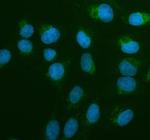 AIRE Polyclonal Antibody
