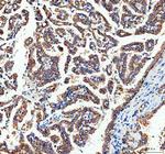 Adenylate Kinase 1 Polyclonal Antibody