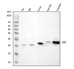 Adenylate Kinase 1 Antibody in Western Blot (WB)