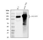 AKAP2 Polyclonal Antibody