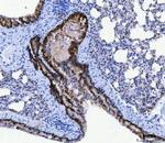CD166 (ALCAM) Antibody in Immunohistochemistry (Paraffin) (IHC (P))