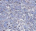 CD166 (ALCAM) Antibody in Immunohistochemistry (Paraffin) (IHC (P))