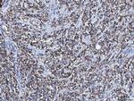 CD166 (ALCAM) Antibody in Immunohistochemistry (Paraffin) (IHC (P))
