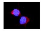 ALDH2 Polyclonal Antibody