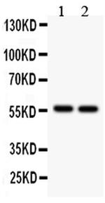 ALDH2 Polyclonal Antibody