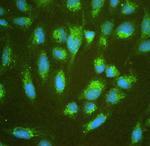 ALDH7A1 Polyclonal Antibody