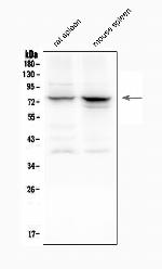 ALOX12 Polyclonal Antibody