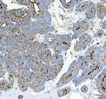 ALPL Polyclonal Antibody
