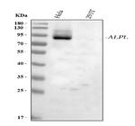 ALPL Antibody in Western Blot (WB)