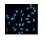 Placental Alkaline Phosphatase Polyclonal Antibody