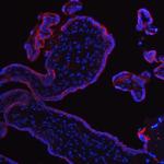 Placental Alkaline Phosphatase Antibody in Immunohistochemistry (Paraffin) (IHC (P))