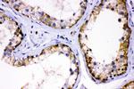 AMHR2 Antibody in Immunohistochemistry (Paraffin) (IHC (P))