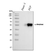 alpha Amylase 1 Polyclonal Antibody
