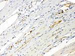 ANGPTL2 Polyclonal Antibody
