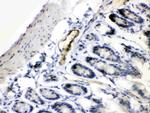 ANGPTL2 Antibody in Immunohistochemistry (Paraffin) (IHC (P))