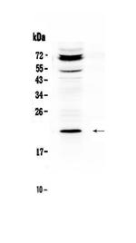 Betatrophin Polyclonal Antibody
