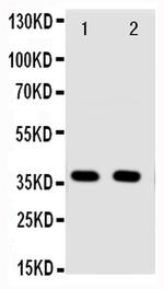 Annexin A10 Antibody in Western Blot (WB)