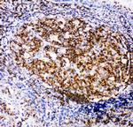 RIAM Antibody in Immunohistochemistry (Paraffin) (IHC (P))