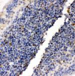 RIAM Antibody in Immunohistochemistry (Paraffin) (IHC (P))
