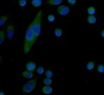 Serum Amyloid P Polyclonal Antibody