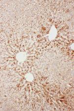 Serum Amyloid P Polyclonal Antibody