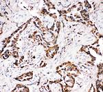 APLP1 Polyclonal Antibody