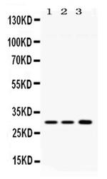 AQP11 Polyclonal Antibody