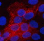 Aquaporin 3 Polyclonal Antibody