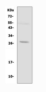 Aquaporin 8 Polyclonal Antibody