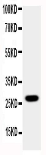 Aquaporin 8 Antibody in Western Blot (WB)
