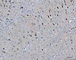 ARFGAP1 Antibody in Immunohistochemistry (Paraffin) (IHC (P))