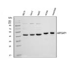 ARFGAP1 Antibody in Western Blot (WB)