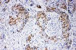 beta Arrestin 1 Polyclonal Antibody