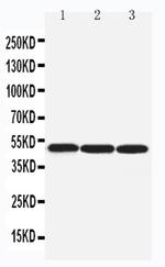 beta Arrestin 1 Antibody in Western Blot (WB)