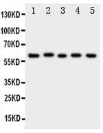ASIC3 Polyclonal Antibody
