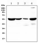 ASL Polyclonal Antibody