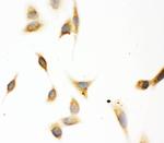 ASPH Polyclonal Antibody