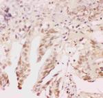 ATF1 Polyclonal Antibody