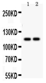 SERCA3 ATPase Antibody in Western Blot (WB)