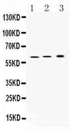 ATP4B Polyclonal Antibody