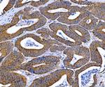 Ataxin 2 Antibody in Immunohistochemistry (Paraffin) (IHC (P))